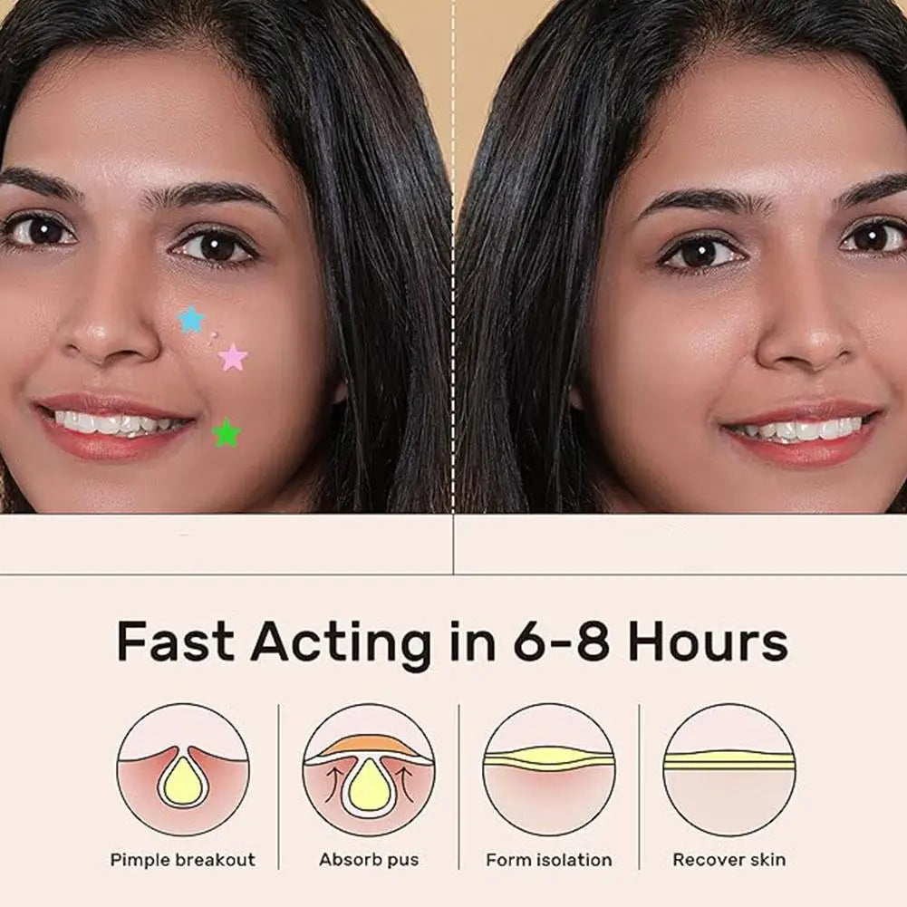 Colorful Star Pimple Patch