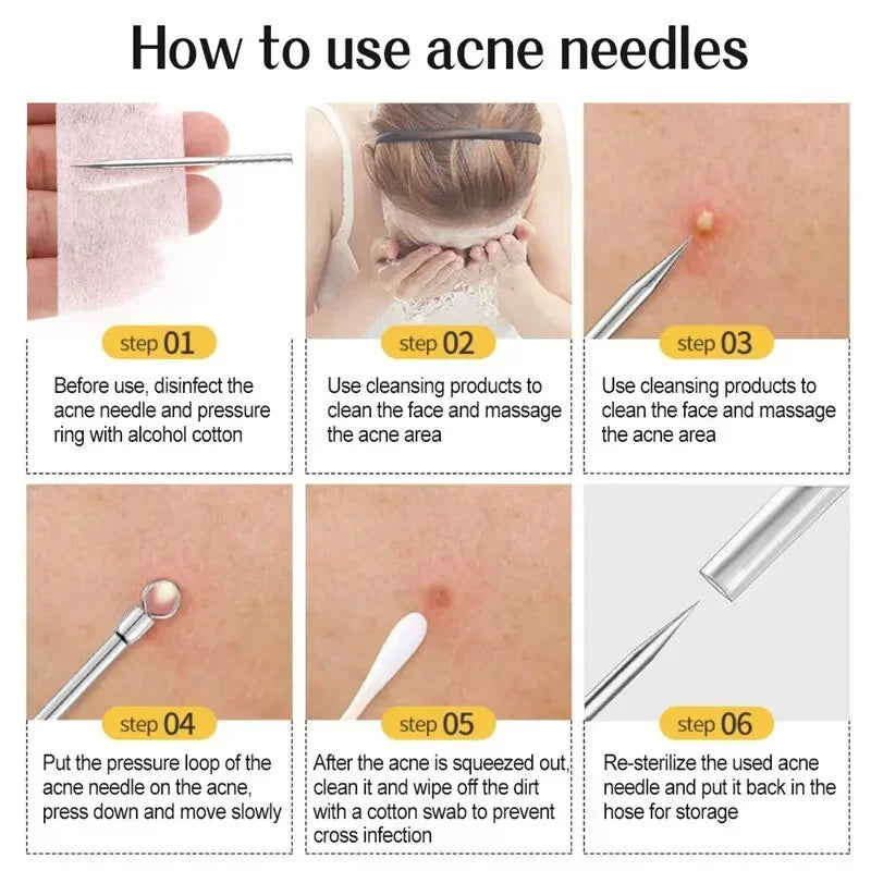 Acne Needle