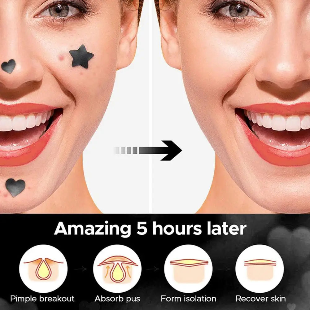 Colorful Star Pimple Patch