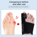 Toe Corrector Orthotics