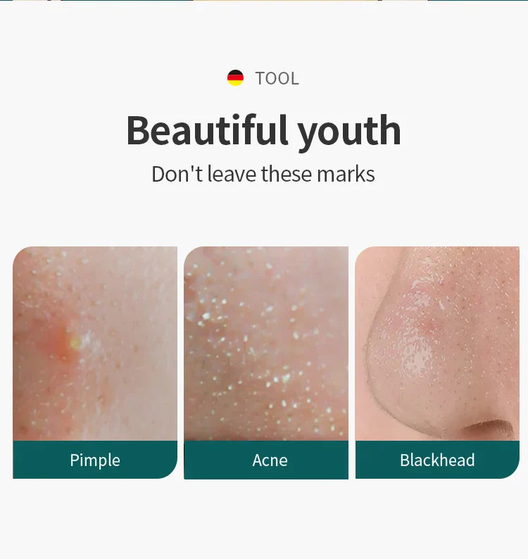 Acne Remover Needles