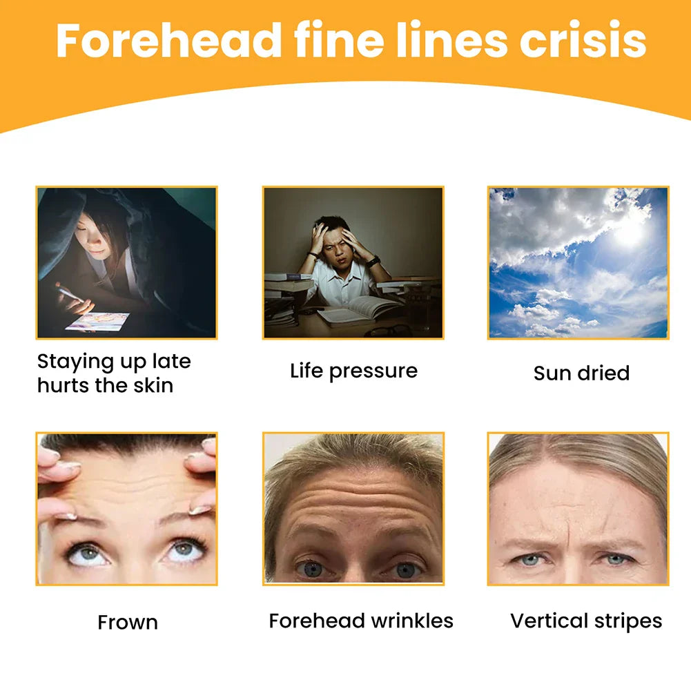 Forehead Wrinkles