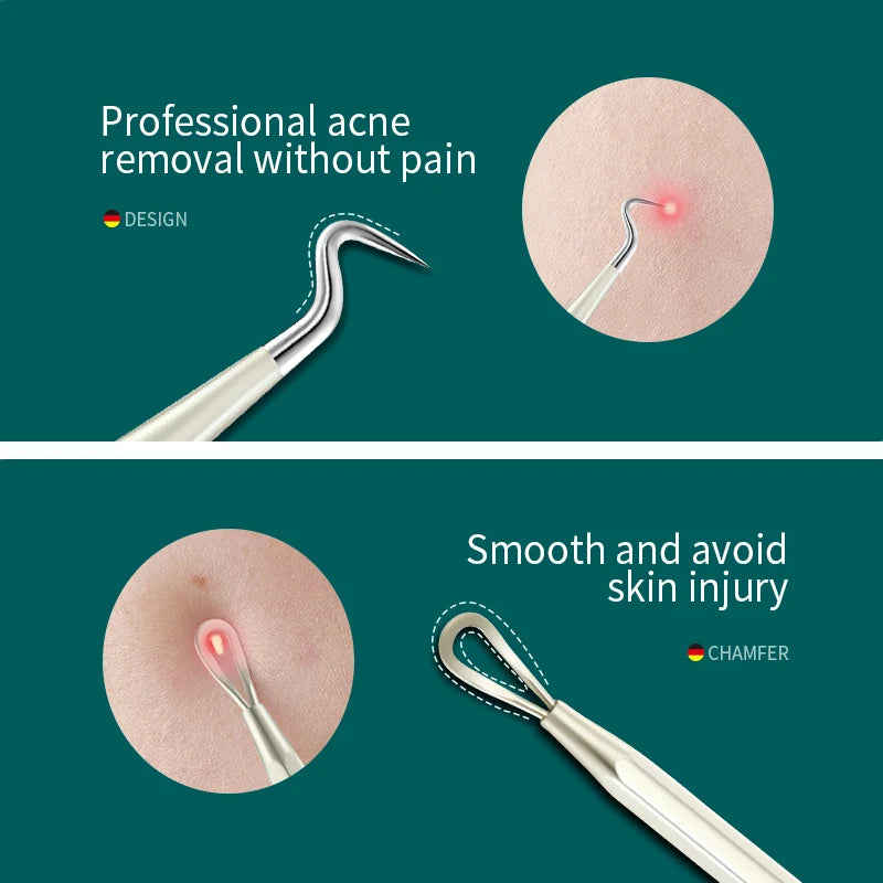 Acne Remover Needles