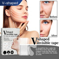 Face Lift Invisible