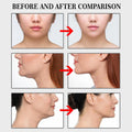 Face Lift Invisible