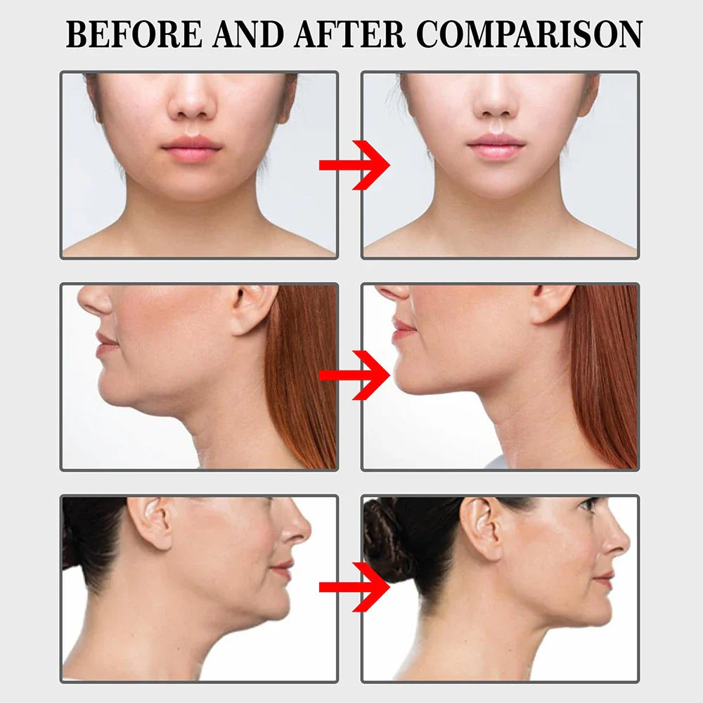Face Lift Invisible