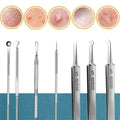 Acne Needle