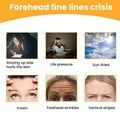 Forehead Wrinkles
